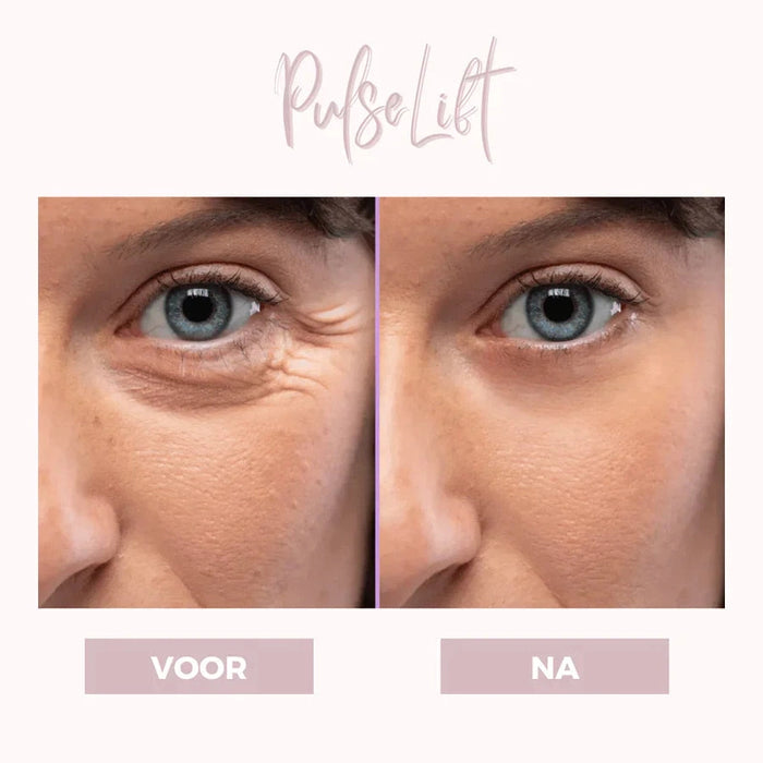 LumeVibe | Ooglift apparaat | Dermatologisch Ontwikkeld