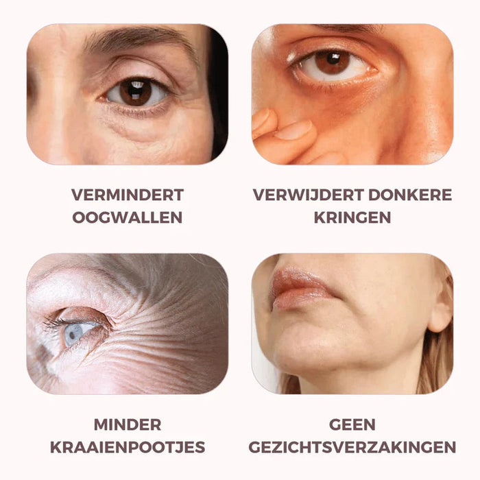 LumeVibe | Ooglift apparaat | Dermatologisch Ontwikkeld